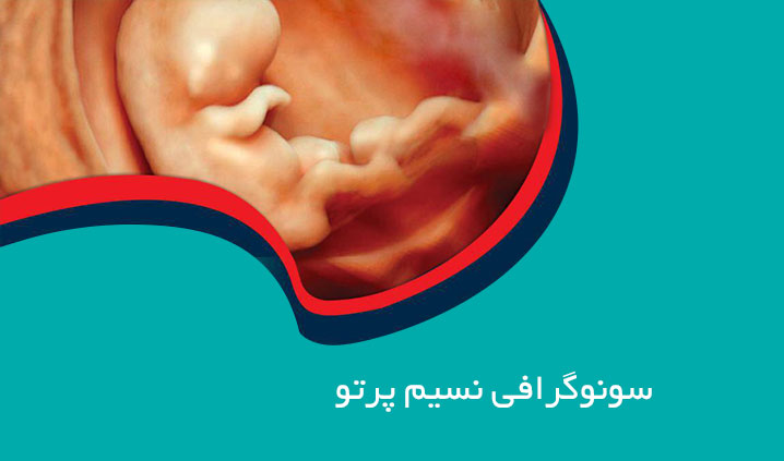 سونوگرافی در منطقه 6